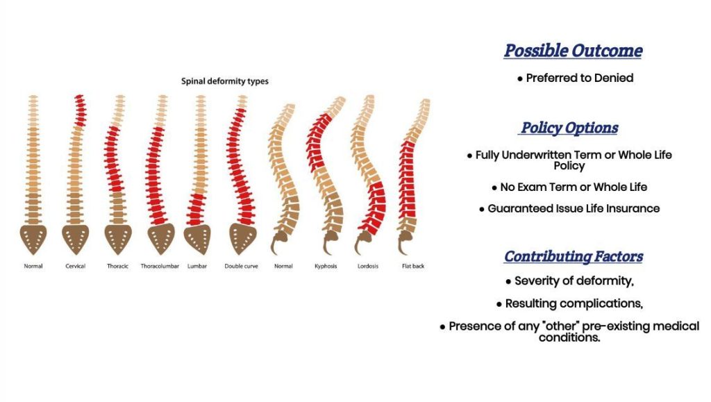 Life Insurance with Kyphosis. Everything You Need to Know at a Glance!